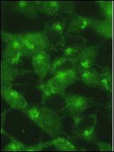 5Y cells were pretreated with 5nM bafilomycin for 24hr and fixed in 4% of paraformaldehyde. Treatment with antibody at dilution 1:100. Data courtesy of Jianhui Zhu, MD, PhD & Charleen T. Chu, MD, PhD, University of Pittsburgh School of Medicine.