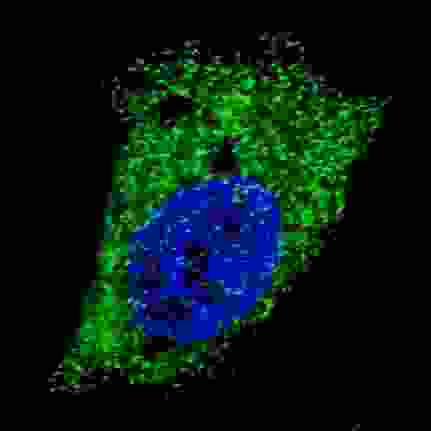 Fluorescent image of U251 cells stained with cleaved LC3A antibody. U251 cells were fixed with 4% PFA (20 min), permeabilized with Triton X-100 (0.2%, 30 min). Cells were then incubated with cleaved LC3A primary antibody (1:100, 2 h at room temperature). For secondary antibody, Alexa Fluor 488 conjugated donkey anti-rabbit antibody (green) was used (1:1000, 1h). Nuclei were counterstained with Hoechst 33342 (blue) (10 ug/ml, 5 min). LC3 immunoreactivity is localized to autophagic vacuoles in the cytoplasm of U251 cells.