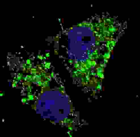 Fluorescent image of U251 cells stained with cleaved LC3A antibody. U251 cells were treated with Chloroquine (50 mu M,16h), then fixed with 4% PFA (20 min), permeabilized with Triton X-100 (0.2%, 30 min). Cells were then incubated cleaved LC3A primary antibody (1:100, 2 h at room temperature). For secondary antibody, Alexa Fluor 488 conjugated donkey anti-rabbit antibody (green) was used (1:1000, 1h). Nuclei were counterstained with Hoechst 33342 (blue) (10 ug/ml, 5 min). LC3 immunoreactivity is localized to autophagic vacuoles in the cytoplasm of U251 cells.