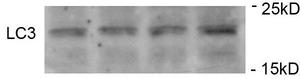 Immunoblots of SH-SY5Y cells treated with MPP+ for 24h was probed. The data shows that treatment with MPP+ showed no significant change in level of LC3.