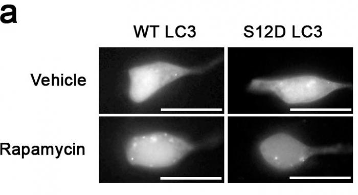 Something like SH-SY5Y cells expressing GFP-LC3-WT or-S12D treated with rapamycin or vehicle for 1h.