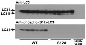 Immunoblots of phosphorylated LC3 (phospho-LC3) in CHO cell culture. LC3 and LC3 S12A mutant vectors were transfected into CHO cells. The cell lysates were separated with SDS-PAGE and blotted with anti-phospho-LC3 S12 antibody. LC3 = microtubule-associated protein light chain-3; S12A = replacement of the amino acid position 12 serine of LC3 with alanine. WT = wild type LC3-transfected cell lysates; S12A = LC3 S12A mutant-transfected cell lysates; Empty vector = vector with no LC3 gene. Molecular size: LC3-I = 16kDa, and LC3-II = 14 kDa