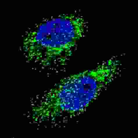 Fluorescent image of U251 cells stained with LC3 (APG8A) (D106) antibody. U251 cells were treated with Chloroquine (50 mu M,16h), then fixed with 4% PFA (20 min), permeabilized with Triton X-100 (0.2%, 30 min). Cells were then incubated LC3 (APG8A) (D106) primary antibody (1:100, 2 h at room temperature). For secondary antibody, Alexa Fluor 488 conjugated donkey anti-rabbit antibody (green) was used (1:1000, 1h). Nuclei were counterstained with Hoechst 33342 (blue) (10 ug/ml, 5 min). LC3 immunoreactivity is localized to autophagic vacuoles in the cytoplasm of U251 cells.