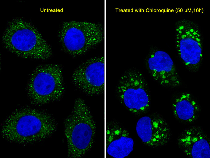 Immunofluorescent of U251 cells, using LC3 Antibody (APG8B). U251 cells(right) were treated with Chloroquine (50 mu M,16h). Antibody was diluted at 1:25 dilution. Alexa Fluor 488-conjugated goat anti-rabbit lgG at 1:400 dilution was used as the secondary antibody (green). DAPI was used to stain the cell nuclear (blue).