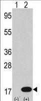 Western blot of anti-LC3 (APG8b) antibody in 293 cell line lysates transiently transfected with the LC3 (APG8b) gene (2 ug/lane). Human LC3 (APG8b) (arrow) was detected using the purified antibody.