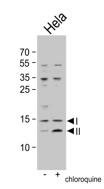 Western blot of anti-LC3 (APG8b) in untreated or treated HeLa cell lysate. Both non-lipidated (arrow, I) and lipidated LC3 (APG8b) (arrow, II) were detected in but pro-LC3 (APG8b) and non-lipidated LC3 ((APG8b) were detected in soluble fraction (S).