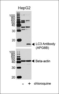 Western blot of lysates from HepG2 cell line, untreated or treated with chloroquine, using LC3 Antibody (upper) or Beta-actin (lower).