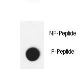Dot blot of anti-Cleaved-APG8b (MAP1LC3B) Phospho-specific antibody on nitrocellulose membrane. 50ng of Phospho-peptide or Non Phospho-peptide per dot were adsorbed. Antibody working concentrations are 0.6ug per ml.