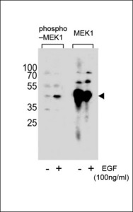 Western blot of extracts from A431 cell,untreated or treated with EGF, 100ng/ml,using Phospho-MEK1-pS222(left) or MEK1-pS222 antibody(right).