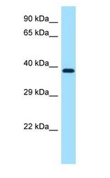 MAP2K1 / MEK1 antibody Western Blot using Mouse Small Intestine Lysate at 1ug/ml..