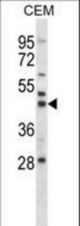 Mouse Map2k2 Antibody western blot of CEM cell line lysates (35 ug/lane). The Map2k2 antibody detected the Map2k2 protein (arrow).