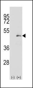Western blot of MAP2K1 (arrow) using rabbit polyclonal MAP2K1 Antibody (S217). 293 cell lysates (2 ug/lane) either nontransfected (Lane 1) or transiently transfected with the MAP2K1 gene (Lane 2) (Origene Technologies).