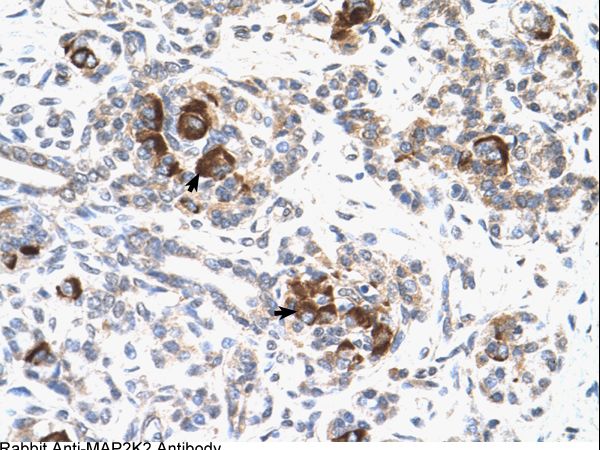 MAP2K2 / MEK2 antibody LS-C81329 was used in IHC to stain formalin-fixed, paraffin-embedded human pancreas.