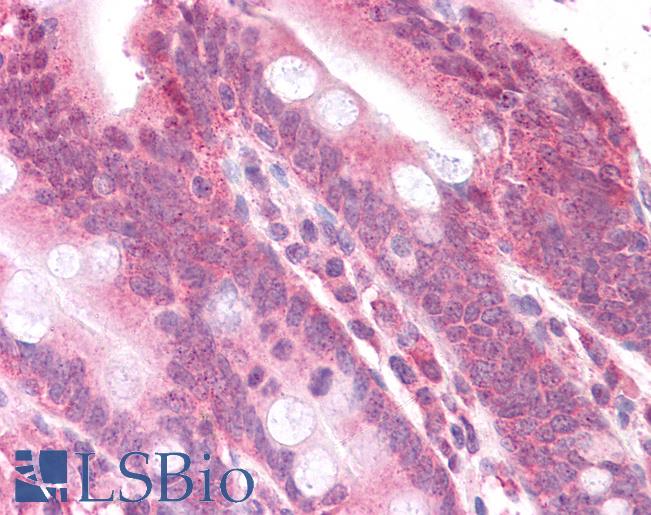 Anti-MAP2K2 / MEK2 antibody IHC of human small intestine. Immunohistochemistry of formalin-fixed, paraffin-embedded tissue after heat-induced antigen retrieval. Antibody LS-B4671 concentration 5 ug/ml.