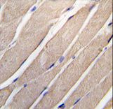 Formalin-fixed and paraffin-embedded human skeletal muscle tissue reacted with MAP2K4 Antibody (S257) , which was peroxidase-conjugated to the secondary antibody, followed by DAB staining. This data demonstrates the use of this antibody for immunohistochemistry; clinical relevance has not been evaluated.