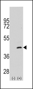 Western blot of MAP2K4 (arrow) using rabbit polyclonal MAP2K4 Antibody (S257). 293 cell lysates (2 ug/lane) either nontransfected (Lane 1) or transiently transfected with the MAP2K4 gene (Lane 2) (Origene Technologies).
