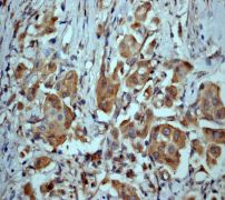 IHC of paraffin-embedded human urinary bladder using anti-MKK7 antibody.