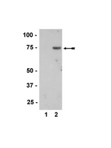 WB: Recombinant MKK7b1 (14-542) was left untreated (Lane 1) or phosphorylated by MEKK1 (14-196) (Lane 2) and probed with anti-phospho-MKK7/SKK4 (Thr275/Ser277) (1:1000 dilution).