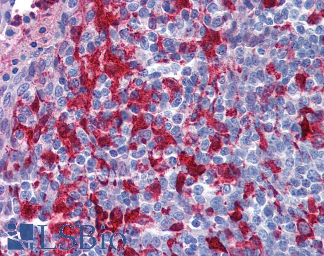 Anti-Gelsolin antibody IHC of human tonsil. Immunohistochemistry of formalin-fixed, paraffin-embedded tissue after heat-induced antigen retrieval. Antibody LS-B5842 concentration 5 ug/ml.