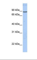 MCF7 cell lysate. Antibody concentration: 1.0 ug/ml. Gel concentration: 12%.