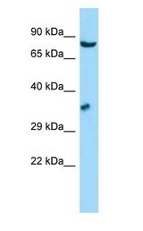 GSPT antibody Western Blot of HepG2.