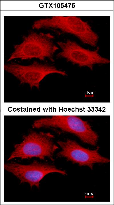 Immunofluorescence of methanol-fixed HeLa, using GSPT1 antibody at 1:500 dilution.