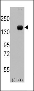 Western blot of MAP3K5 (arrow) using rabbit polyclonal MAP3K5 Antibody. 293 cell lysates (2 ug/lane) either nontransfected (Lane 1) or transiently transfected with the MAP3K5 gene (Lane 2) (Origene Technologies).