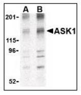 Western blot of ASK1 in 3T3 cell lysate with LS-B3206 at (A) 1 and (B) 2 ug/ml.