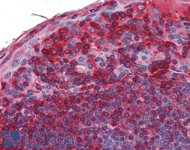 Anti-MAP3K7 / TAK1 antibody IHC of human tonsil. Immunohistochemistry of formalin-fixed, paraffin-embedded tissue after heat-induced antigen retrieval. Antibody LS-B3754 concentration 5 ug/ml.