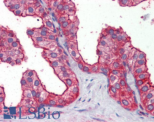 Anti-MAP3K7 / TAK1 antibody IHC of human prostate. Immunohistochemistry of formalin-fixed, paraffin-embedded tissue after heat-induced antigen retrieval. Antibody LS-B3754 concentration 5 ug/ml.