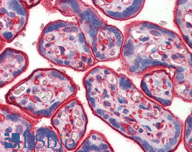 Anti-MAP3K7 / TAK1 antibody IHC of human placenta. Immunohistochemistry of formalin-fixed, paraffin-embedded tissue after heat-induced antigen retrieval. Antibody LS-B3754 concentration 5 ug/ml.