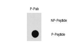Dot blot of Phospho-MAP3K7-T187 polyclonal antibody on nitrocellulose membrane. 50ng of Phospho-peptide or Non Phospho-peptide per dot were adsorbed. Antibody working concentration were 0.5ug per ml.