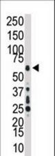 Western blot of anti-TAK1 antibody in HL60 cell lysate. TAK1 (arrow) was detected using purified antibody. Secondary HRP-anti-rabbit was used for signal visualization with chemiluminescence.