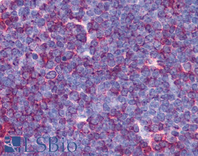 Anti-MAP3K7 / TAK1 antibody IHC of human thymus. Immunohistochemistry of formalin-fixed, paraffin-embedded tissue after heat-induced antigen retrieval. Antibody LS-B18 concentration 5 ug/ml.