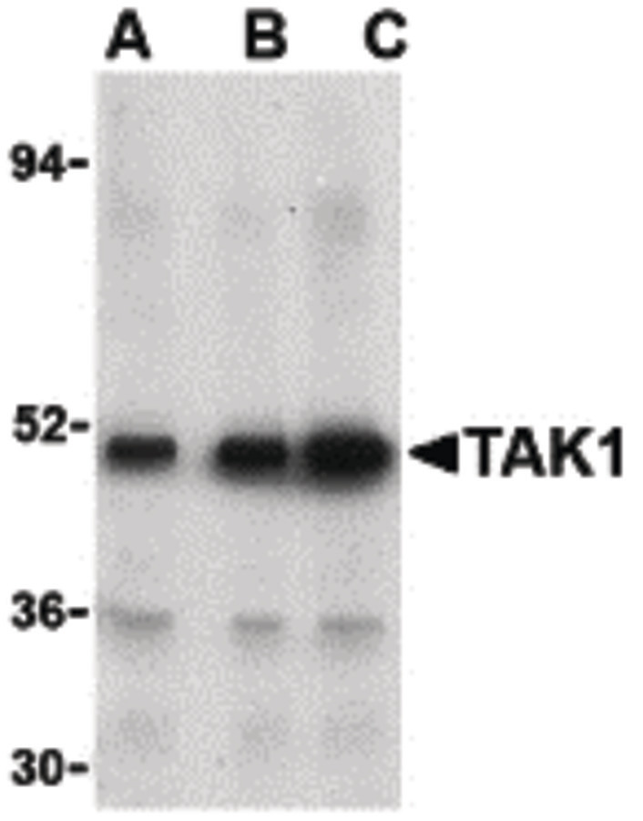 Western blot of TAK1 in Rat thymus cell lysate with TAK1 antibody at (A) 1, (B) 2, and (C) 4 ug/ml.
