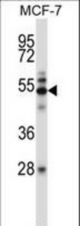 Mouse Map3k7 Antibody western blot of MCF-7 cell line lysates (35 ug/lane). The Map3k7 antibody detected the Map3k7 protein (arrow).