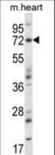 Mouse Map3k7 Antibody western blot of mouse heart tissue lysates (35 ug/lane). The Map3k7 antibody detected the Map3k7 protein (arrow).