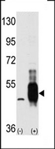 Western blot of MEKK8 (arrow) using MEKK8 Antibody. 293 cell lysates (2 ug/lane) either nontransfected (Lane 1) or transiently transfected with the MAP3K8 gene (Lane 2) (Origene Technologies).