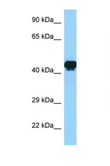 GORAB / SCYL1BP1 antibody LS-C146303 Western blot of Fetal Brain lysate. Antibody concentration 1 ug/ml.