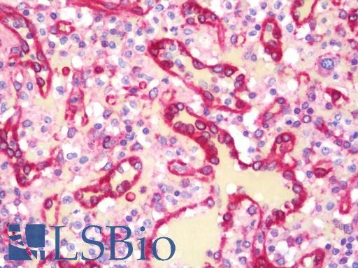 Anti-MAP4 antibody IHC staining of human spleen. Immunohistochemistry of formalin-fixed, paraffin-embedded tissue after heat-induced antigen retrieval. Antibody LS-B11054 dilution 1:100.