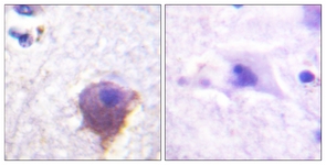 IHC of paraffin-embedded human brain tissue, using MAP4 Antibody. The sample on the right was incubated with synthetic peptide.