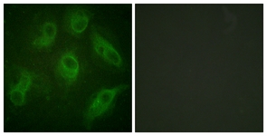 Immunofluorescence of HeLa cells, using MAP4 Antibody. The sample on the right was incubated with synthetic peptide.