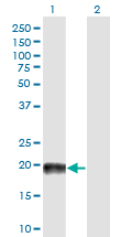 Western blot of MAP4 expression in transfected 293T cell line by MAP4 monoclonal antibody (M03), clone 7C9.