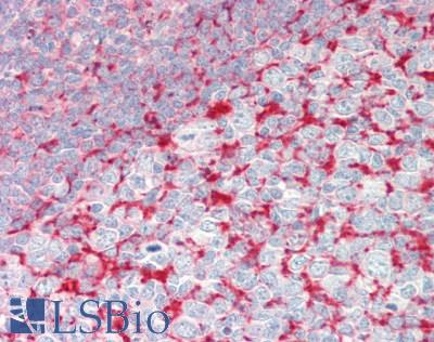 Human Tonsil: Formalin-Fixed, Paraffin-Embedded (FFPE)
