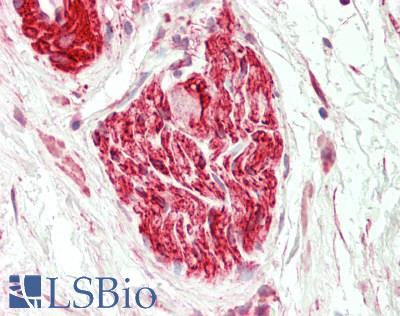 Human Peripheral Nerve: Formalin-Fixed, Paraffin-Embedded (FFPE)