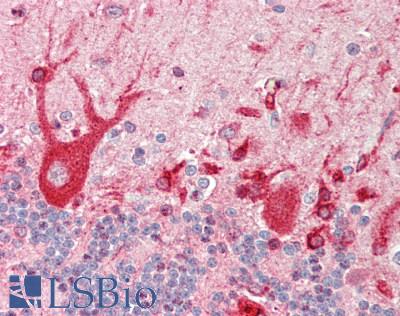 Human Brain, Cerebellum: Formalin-Fixed, Paraffin-Embedded (FFPE)