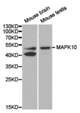 Western blot of extracts of various cell lines, using JNK3/MAPK10 antibody.