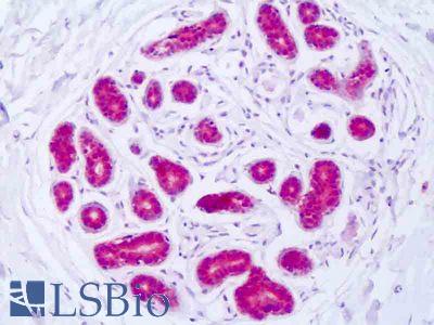 Anti-GSS / Glutathione Synthetase antibody IHC of human breast epithelium. Immunohistochemistry of formalin-fixed, paraffin-embedded tissue after heat-induced antigen retrieval. Antibody LS-B8481 dilution 1:50-1:100.