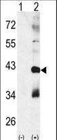 Western blot of CTDSP1 (arrow) using rabbit polyclonal p38 beta Antibody. 293 cell lysates (2 ug/lane) either nontransfected (Lane 1) or transiently transfected with the CTDSP1 gene (Lane 2) (Origene Technologies).