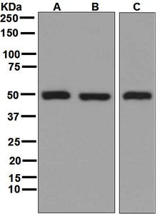 Western blot analysis on (A) 293T, (B) HeLa, (C) HT-1080 cell lysates using anti-GSS antibody.